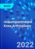 Unicompartmental Knee Arthroplasty- Product Image