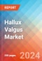 Hallux Valgus - Market Insight, Epidemiology and Market Forecast - 2034 - Product Image