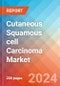 Cutaneous Squamous cell Carcinoma (CsCC) - Market Insight, Epidemiology and Market Forecast - 2034 - Product Image