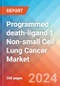Programmed death-ligand 1 (PD-L1) Non-small Cell Lung Cancer (NSCLC) - Market Insight, Epidemiology and Market Forecast - 2034 - Product Image