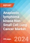 Anaplastic lymphoma kinase Non-Small Cell Lung Cancer (ALK-NSCLC) - Market Insight, Epidemiology and Market Forecast -2032 - Product Thumbnail Image