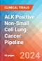 ALK Positive Non-Small Cell Lung Cancer - Pipeline Insight, 2024 - Product Thumbnail Image