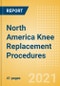 North America Knee Replacement Procedures Outlook to 2025 - Partial Knee Replacement Procedures, Primary Knee Replacement Procedures Revision and Knee Replacement Procedures - Product Thumbnail Image