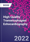 High-Quality Transesophageal Echocardiography- Product Image