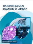 Histopathological Diagnosis of Leprosy- Product Image