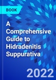 A Comprehensive Guide to Hidradenitis Suppurativa- Product Image