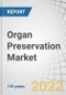 Organ Preservation Market by Solution (UW, Custodial HTK, Perfadex), Technique (Static Cold Storage, Hypothermic, Normothermic), Organ (Kidneys, Liver, Heart), End-user (Transplant Centers, Hospitals, Specialty Clinics), and Region - Forecast to 2026 - Product Thumbnail Image