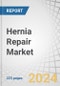 Hernia Repair Market by Product (Mesh (Synthetic, Biologic), Suture (Absorbable, Non-Absorbable), Tack, Glue Applicator), Indication (Inguinal, Incisional, Umbilical, Epigastric, Femoral, Hiatal), Surgery, End-user - Forecast to 2029 - Product Thumbnail Image