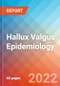 Hallux Valgus Epidemiology Forecast to 2032 - Product Thumbnail Image