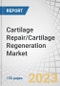 Cartilage Repair/Cartilage Regeneration Market by Treatment Modalities (Cell-Based (Chondrocyte Transplantation, Stem Cells, Growth Factors), Non-Cell (Tissue Scaffolds)), Application (Hyaline, Fibrocartilage), Site, and Region - Forecast to 2028 - Product Image