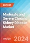 Moderate and Severe Chronic Kidney Disease (CKD) - Market Insight, Epidemiology and Market Forecast - 2034 - Product Image