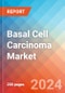 Basal Cell Carcinoma (Basal Cell Epithelioma) - Market Insight, Epidemiology and Market Forecast - 2032 - Product Thumbnail Image