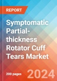 Symptomatic Partial-thickness Rotator Cuff Tears (sPTRCT) - Market Insight, Epidemiology and Market Forecast - 2034- Product Image