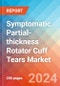 Symptomatic Partial-thickness Rotator Cuff Tears (sPTRCT) - Market Insight, Epidemiology and Market Forecast - 2034 - Product Image