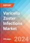 Varicella Zoster (HHV-3) Infections - Market Insight, Epidemiology and Market Forecast - 2034 - Product Image