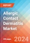 Allergic Contact Dermatitis - Market Insight, Epidemiology and Market Forecast -2032 - Product Thumbnail Image