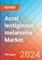Acral lentiginous melanoma - Market Insight, Epidemiology and Market Forecast -2032 - Product Thumbnail Image