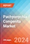 Pachyonychia Congenita - Market Insight, Epidemiology and Market Forecast - 2034 - Product Image
