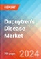 Dupuytren's Disease - Market Insight, Epidemiology and Market Forecast - 2034 - Product Thumbnail Image