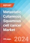 Metastatic Cutaneous Squamous cell cancer - Market Insight, Epidemiology and Market Forecast - 2034 - Product Image