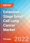 Extensive-Stage Small Cell Lung Cancer (ESCLC) - Market Insight, Epidemiology and Market Forecast -2032 - Product Thumbnail Image