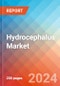 Hydrocephalus - Market Insight, Epidemiology and Market Forecast - 2034 - Product Thumbnail Image