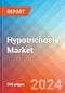 Hypotrichosis - Market Insight, Epidemiology and Market Forecast - 2034 - Product Thumbnail Image