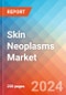 Skin Neoplasms - Market Insight, Epidemiology and Market Forecast - 2034 - Product Image