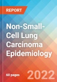 Non-Small-Cell Lung Carcinoma (NSCLC) - Epidemiology Forecast to 2032- Product Image