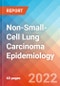 Non-Small-Cell Lung Carcinoma (NSCLC) - Epidemiology Forecast to 2032 - Product Thumbnail Image