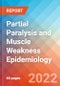 Partial Paralysis and Muscle Weakness - Epidemiology Forecast - 2032 - Product Thumbnail Image