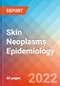 Skin Neoplasms - Epidemiology Forecast to 2032 - Product Thumbnail Image