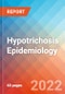 Hypotrichosis - Epidemiology Forecast - 2032 - Product Thumbnail Image