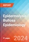 Epidermolysis Bullosa - Epidemiology Forecast - 2034 - Product Image