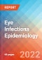 Eye Infections - Epidemiology Forecast to 2032 - Product Thumbnail Image