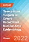 Severe Acne Vulgaris or Severe Recalcitrant Nodular Acne - Epidemiology Forecast to 2032 - Product Thumbnail Image