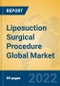 Liposuction Surgical Procedure Global Market Insights 2022, Analysis and Forecast to 2027, by Manufacturers, Regions, Technology, Application, Product Type - Product Thumbnail Image