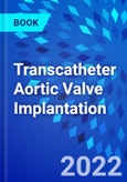 Transcatheter Aortic Valve Implantation- Product Image