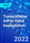 Transcatheter Aortic Valve Implantation - Product Thumbnail Image