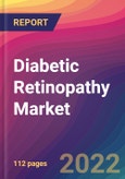 Diabetic Retinopathy Market: Size, Share, Application Analysis, Regional Outlook, Growth Trends, Key Players, Competitive Strategies and Forecasts, 2022-2030- Product Image