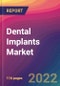 Dental Implants Market Size, Market Share, Application Analysis, Regional Outlook, Growth Trends, Key Players, Competitive Strategies and Forecasts - 2022 to 2030 - Product Image