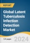 Global Latent Tuberculosis Infection Detection Market Size, Share & Trends Analysis Report by Brand (QFT-Plus), Test Type, Application, End-use, Region, and Segment Forecasts, 2024-2030 - Product Image
