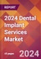 2024 Dental Implant Services Global Market Size & Growth Report with Updated Recession Risk Impact - Product Image