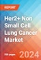 Her2+ Non Small Cell Lung Cancer - Market Insight, Epidemiology and Market Forecast - 2032 - Product Thumbnail Image