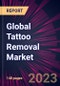 Global Tattoo Removal Market 2024-2028 - Product Image