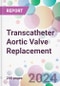 Transcatheter Aortic Valve Replacement Market Analysis & Forecast to 2024-2034 - Product Thumbnail Image