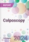 Colposcopy Market Analysis & Forecast to 2024-2034 - Product Image