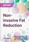 Non-invasive Fat Reduction Market Analysis & Forecast to 2024-2034 - Product Thumbnail Image