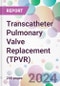 Transcatheter Pulmonary Valve Replacement (TPVR) Market Analysis & Forecast to 2024-2034 - Product Thumbnail Image