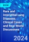 Rare and Interstitial Lung Diseases. Clinical Cases and Real-World Discussions - Product Thumbnail Image